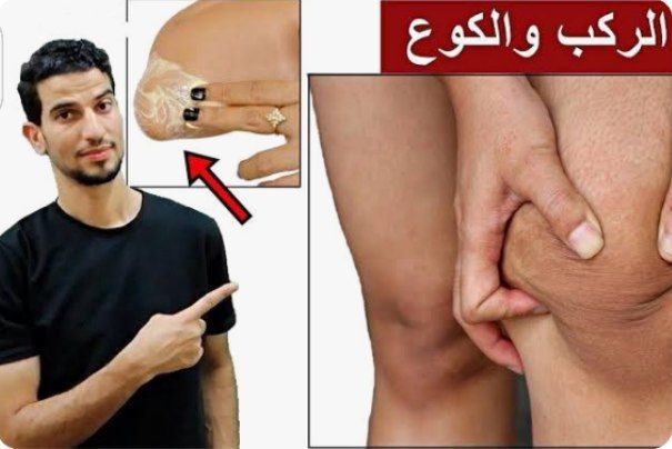 طريقة تبييض البشرة والتخلص من سواد الكوع والرقبة في 5 أيام فقط تفتيح السواد!